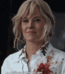 a woman in a white shirt with blood on her shirt is talking about what she got .