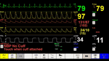 Hospital Monitor GIF