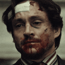 a man with a bandage on his head and blood on his face