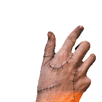 a hand with stitches on it is reaching out