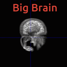 Big Brain Smart GIF - Big Brain Smart Good Idea GIFs