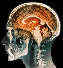 a drawing of a human head with a skull and a brain