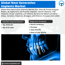 Next Generation Implants Market GIF - Next Generation Implants Market GIFs